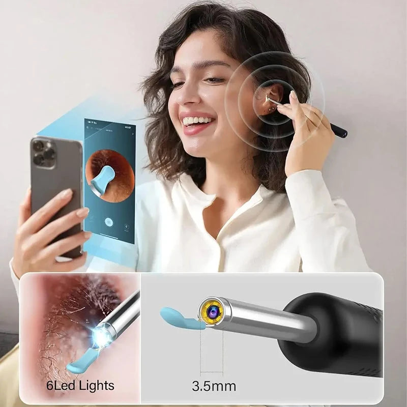 Wireless Ear Cleaning Otoscope – WiFi Camera with Light for Ear & Oral Care
