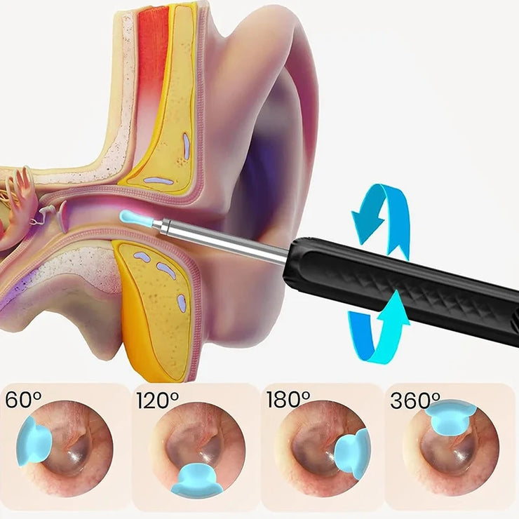 Wireless Ear Cleaning Otoscope – WiFi Camera with Light for Ear & Oral Care