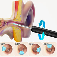 Wireless Ear Cleaning Otoscope – WiFi Camera with Light for Ear & Oral Care